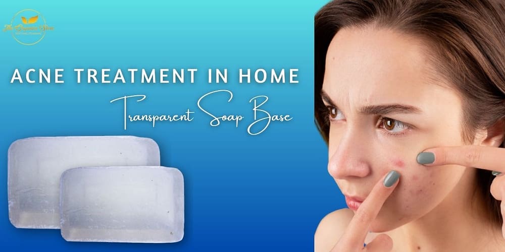 Acne Treatment in Home