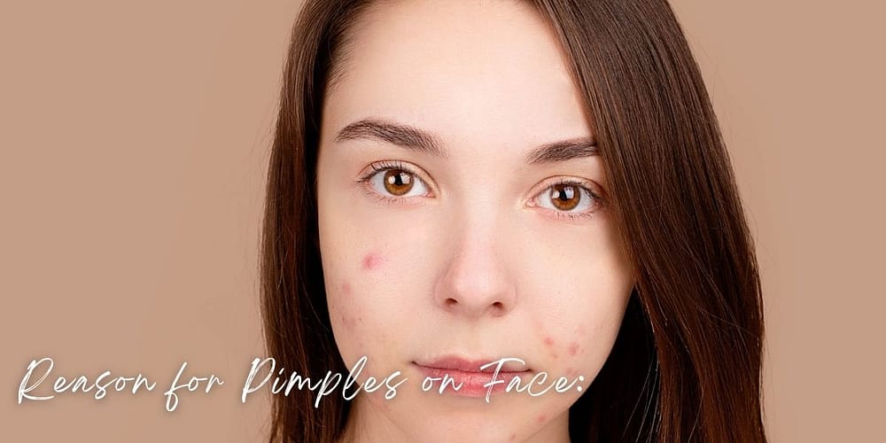 clear-skin-secrets-8-reason-for-pimples-on-face-and-proven-solutions