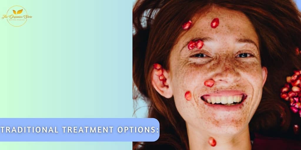hyperpigmentation treatment on face