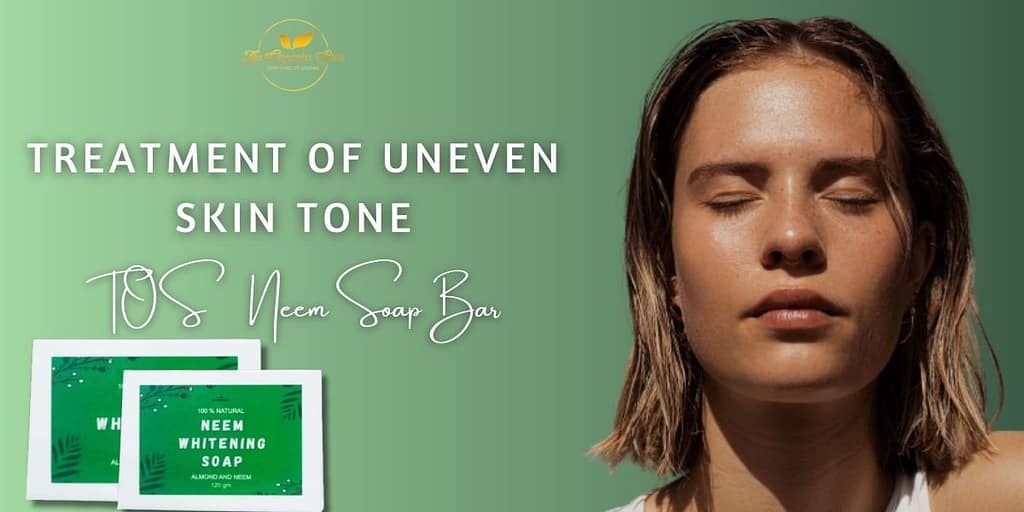Treatment of Uneven Skin Tone