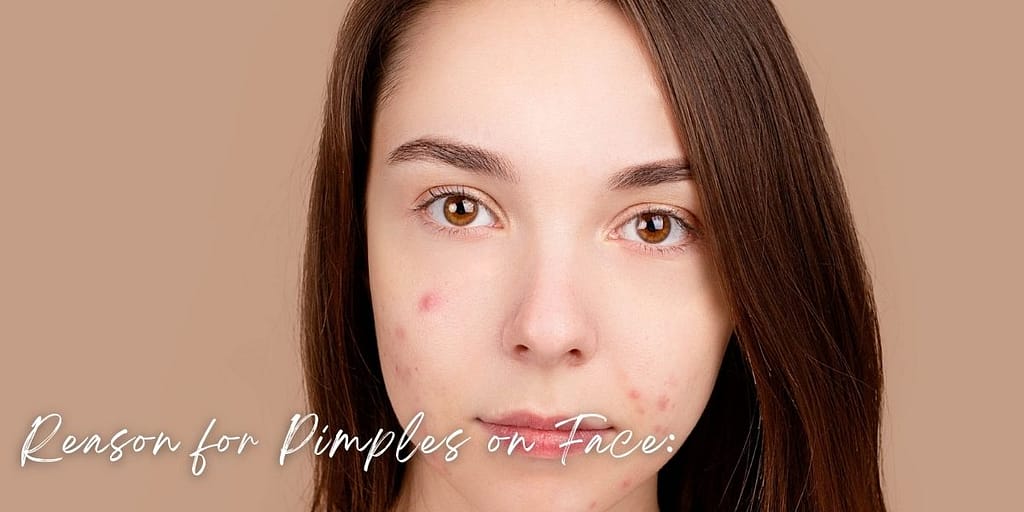 What Causes Pimples on the face