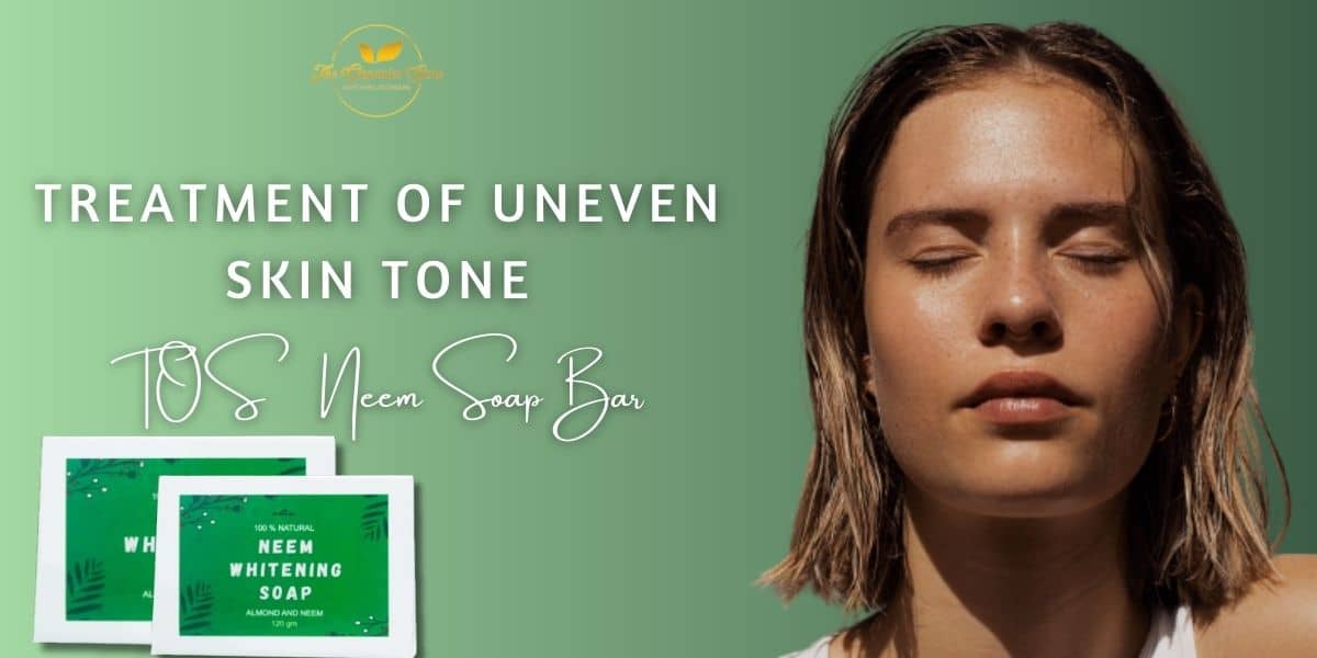 Treatment of Uneven Skin Tone