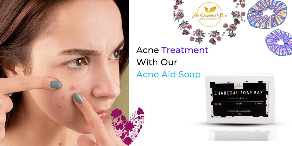 acne aid soap